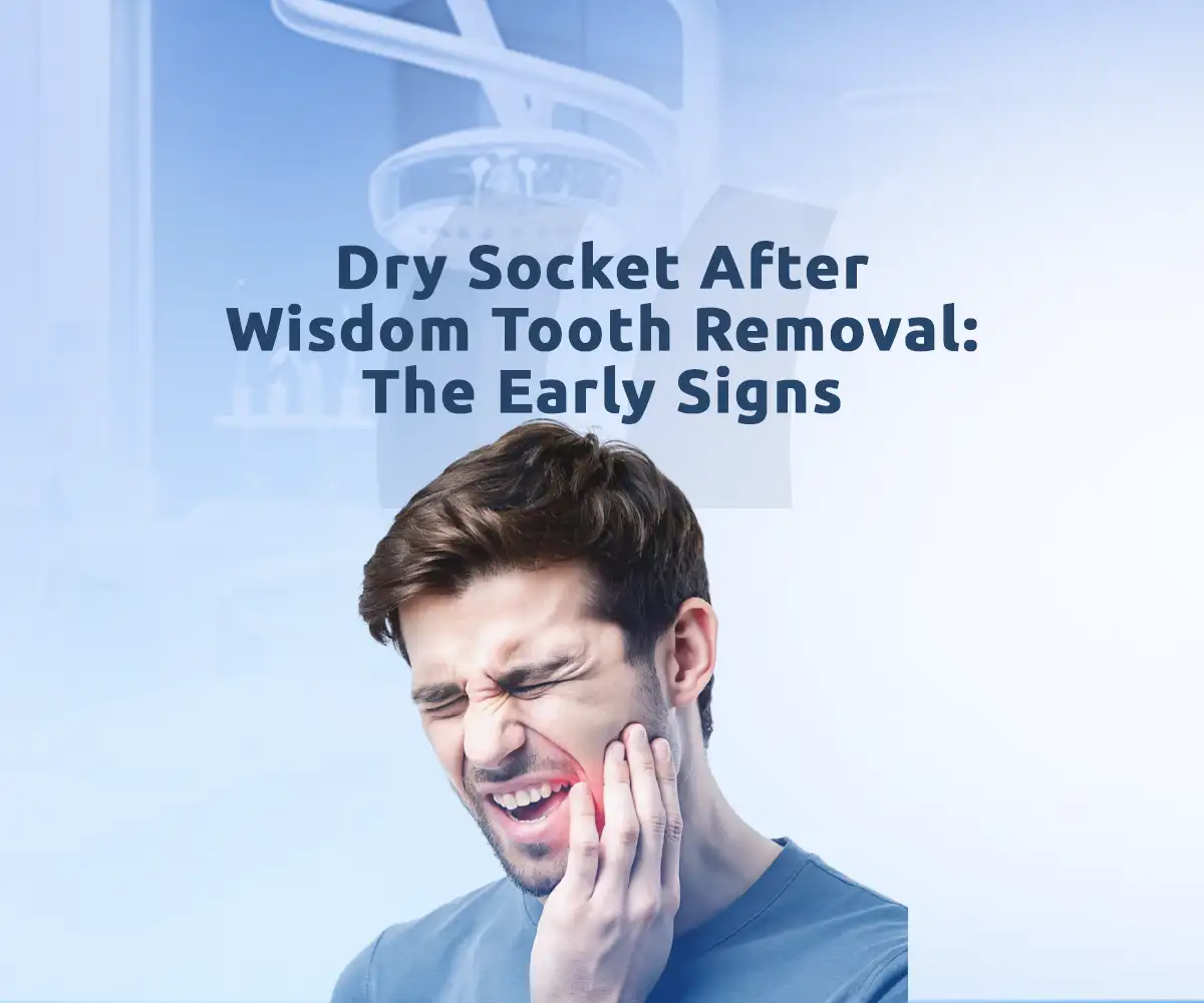 dry socket after wisdom tooth removal symptoms