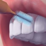 Arayüz fırçası, dişler arasındaki dar aralıkları temizlemek için tasarlanmış bir araçtır. Diş ipi kullanımı kadar etkilidir.
