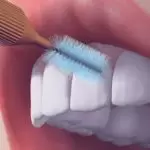 Brosse interdentaire 3 Une brosse interdentaire est un outil conçu pour nettoyer les espaces étroits entre les dents. C'est aussi efficace que l'utilisation de fil dentaire.