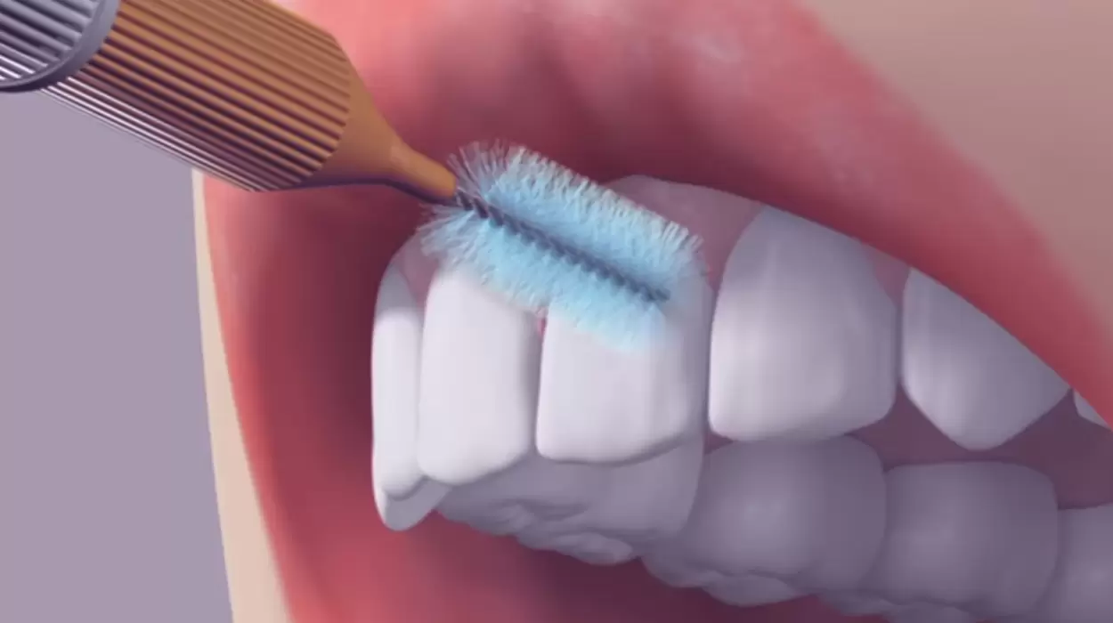 Un cepillo interdental es una herramienta diseñada para limpiar los espacios estrechos entre los dientes. Es tan efectivo como usar hilo dental.