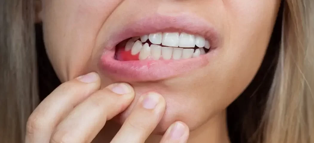 Çeneden Neden Ses Gelir? Çeşitli sebeplerden kaynaklanabilir, bu sesler genellikle çene eklemlerinin aktivitesiyle ya da diş gıcırdatmayla ilgili olabilir.