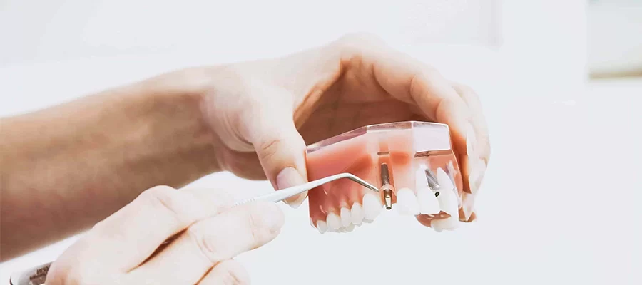 La tomographie volumétrique dentaire est une technologie d’imagerie avancée qui fournit aux dentistes une image 3D détaillée des dents et des tissus environnants.