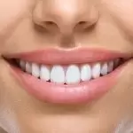 El tratamiento de la recesión de las encías en Estambul es un servicio saludable y de calidad ofrecido individualmente por nuestros dentistas expertos en Aliadent.