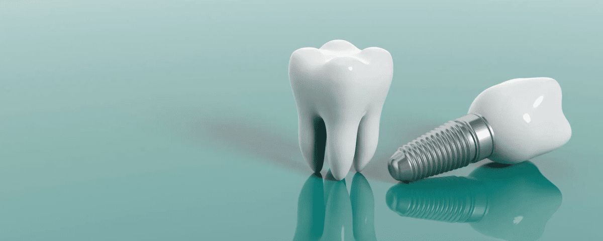 Aliadent kliniğimizde implant diş fiyatları, malzeme kalitesi ve tedavi gereksinimleri gibi bazı faktörlere bağlı olarak değişir.