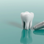 Aliadent kliniğimizde implant diş fiyatları, malzeme kalitesi ve tedavi gereksinimleri gibi bazı faktörlere bağlı olarak değişir.