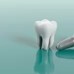 Dans notre clinique Aliadent, les prix des implants dentaires varient en fonction de certains facteurs tels que la qualité du matériau et les exigences de traitement.