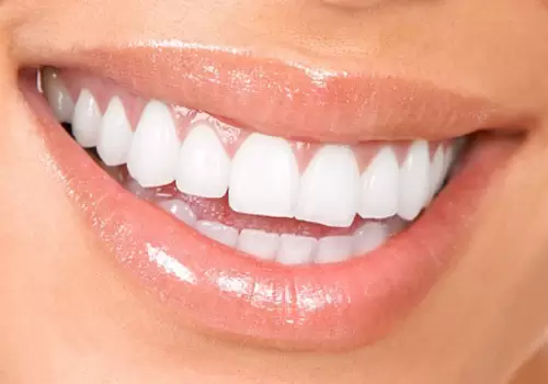 Dans le processus d'esthétique du sourire Levent, les dentistes visent à obtenir un sourire naturel et esthétique en tenant compte des souhaits et des besoins des patients.