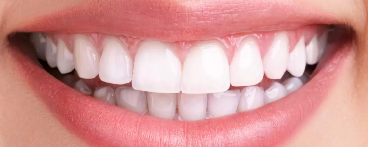 С Aliadent, Levent smile design в Истанбул осигурява персонализирана грижа от експерти, които предоставят естетични дентални услуги.