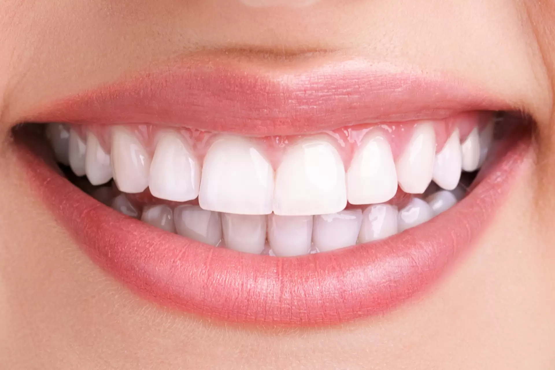 С Aliadent, Levent smile design в Истанбул осигурява персонализирана грижа от експерти, които предоставят естетични дентални услуги.