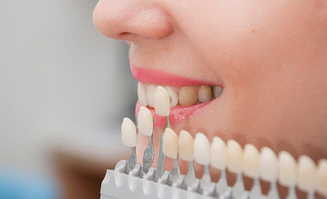 İstanbul Sultanbeyli'deki diş implantı hizmetimiz, uzman diş hekimleri tarafından sunulan kaliteli ve güvenilir diş restorasyonlarıdır.