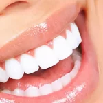 Las coronas de zirconio son una opción duradera y de aspecto natural ampliamente utilizada en la restauración dental estética. El circonio proporciona una solución duradera.