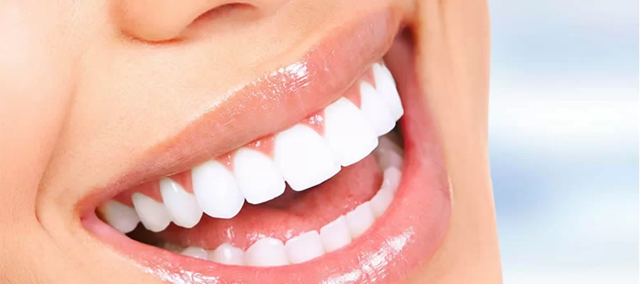 Les couronnes en zirconium sont une option durable et d’apparence naturelle largement utilisée dans la restauration dentaire esthétique. Le zirconium offre une solution durable.