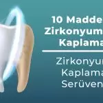 Научете основната информация за циркониевото зъбно покритие в 10 статии.