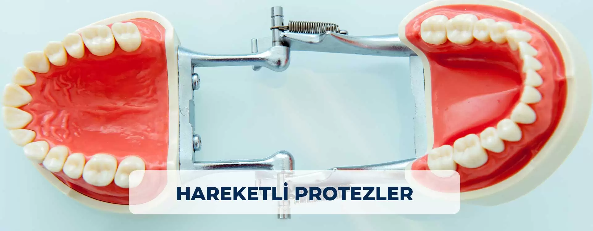 Ne laissez pas vos dents manquantes vous contrarier ! Des sourires confiants avec des prothèses dentaires amovibles à Istanbul. Obtenez des solutions dentaires permanentes abordables.