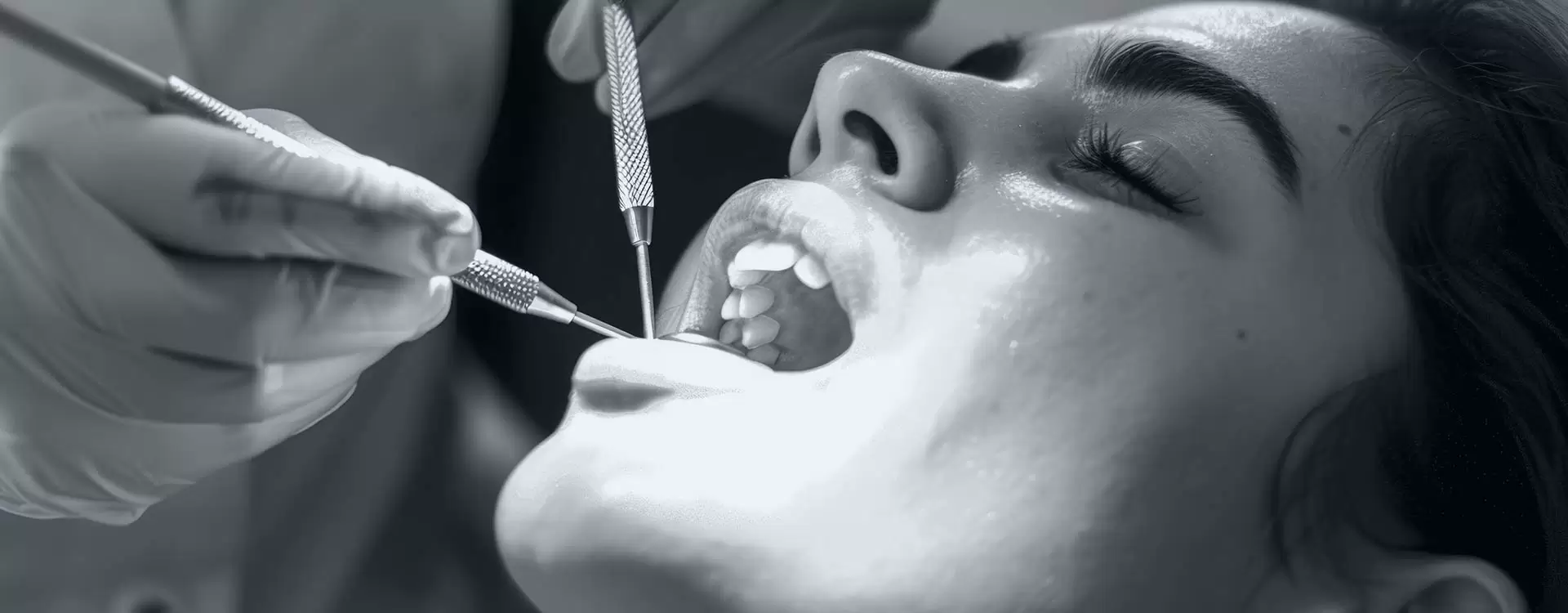 Aliadent ile diş çekimi teknikleri hakkında önemli bilgilere ulaşın.