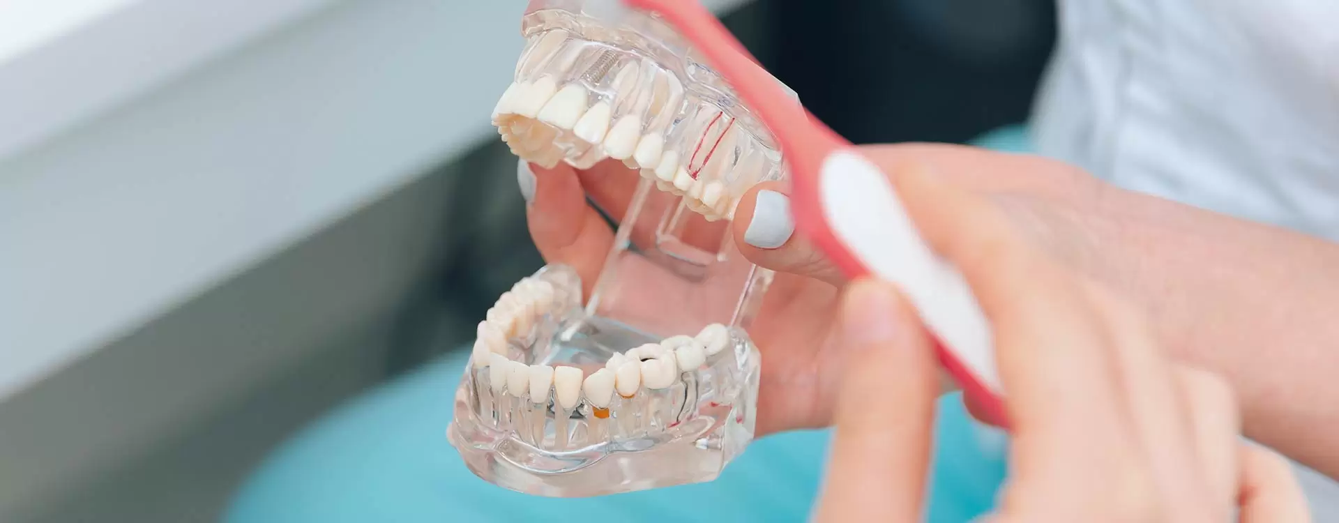 Solutions esthétiques et fonctionnelles avec prothèses amovibles proposées par Aliadent.