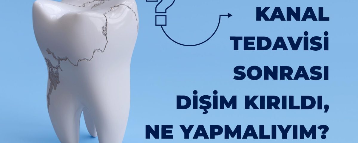Kanal tedavisi sonrası diş kırılması - Ne yapılmalı?