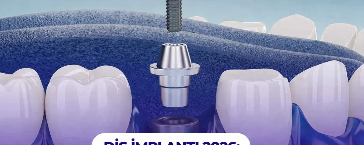 dis implanti 2026 fiyatlar markalar ve tedavi sureci