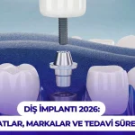 dis implanti 2026 fiyatlar markalar ve tedavi sureci