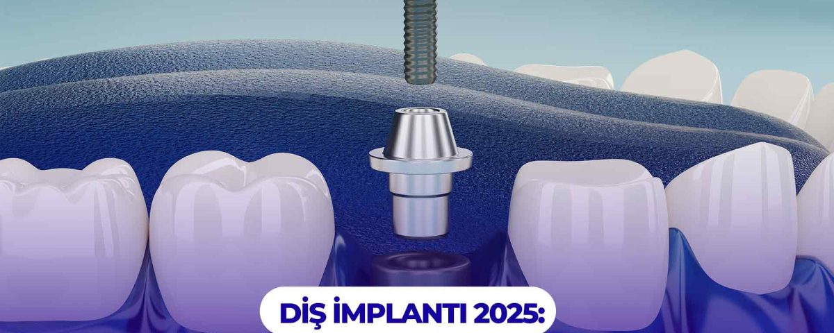 Diş implantı fiyatları 2025