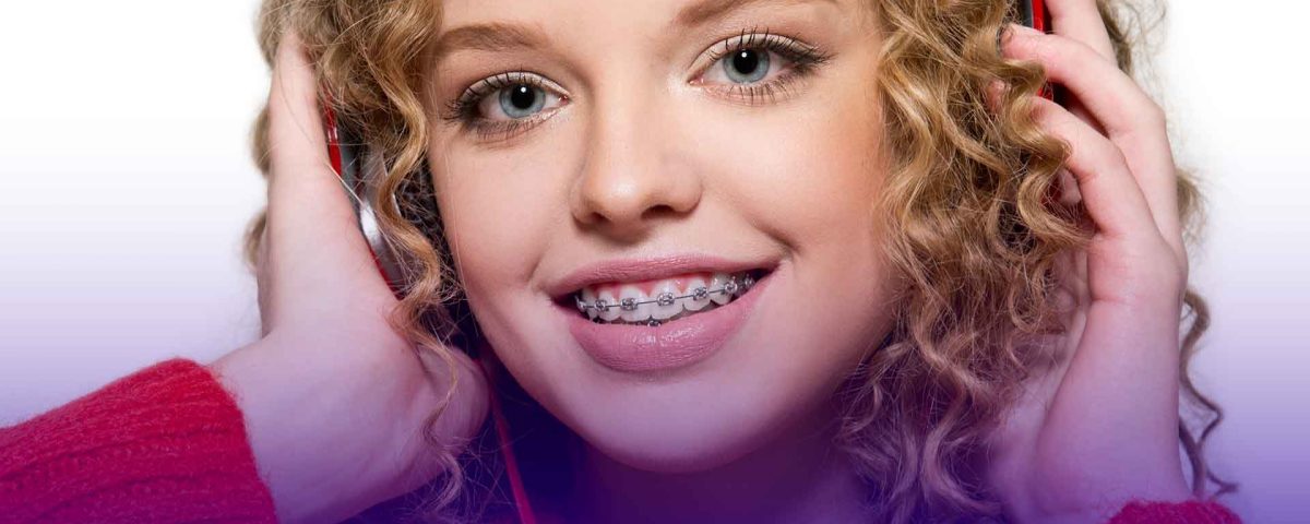 Diş teli nasıl takılır ve tedavi süreci nasıldır