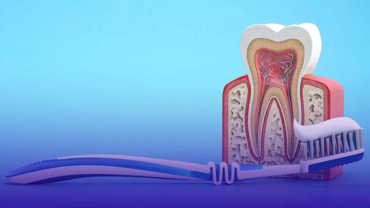 La douleur du canal radiculaire est généralement causée par une inflammation et une sensibilité post-traitement, mais peut être soulagée par des méthodes de traitement appropriées.