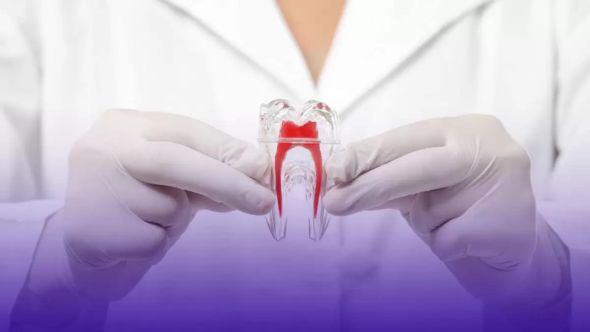 Les étapes du traitement du canal radiculaire comprennent le nettoyage du tissu dentaire infecté et le remplissage de la dent.