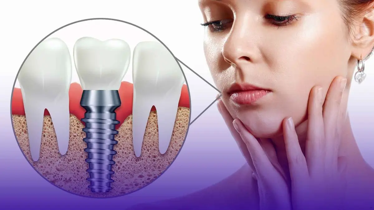 Información sobre precios de implantes dentales y duración del tratamiento.