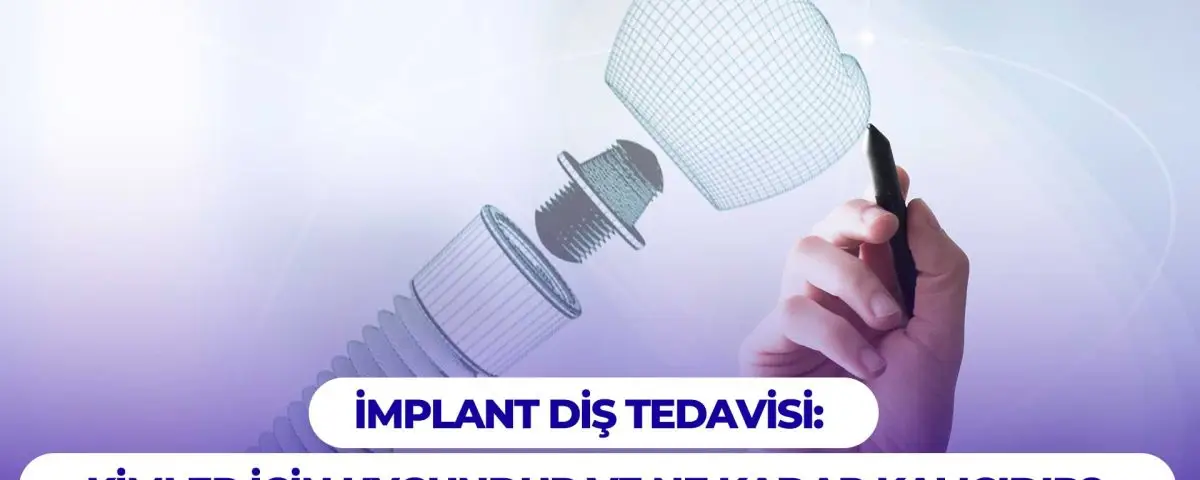 ¿Quién es apto para el tratamiento con implantes dentales y qué tan permanente es?