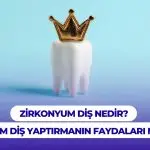 Informations sur ce que sont les dents en zirconium et les avantages d'avoir des dents en zirconium.