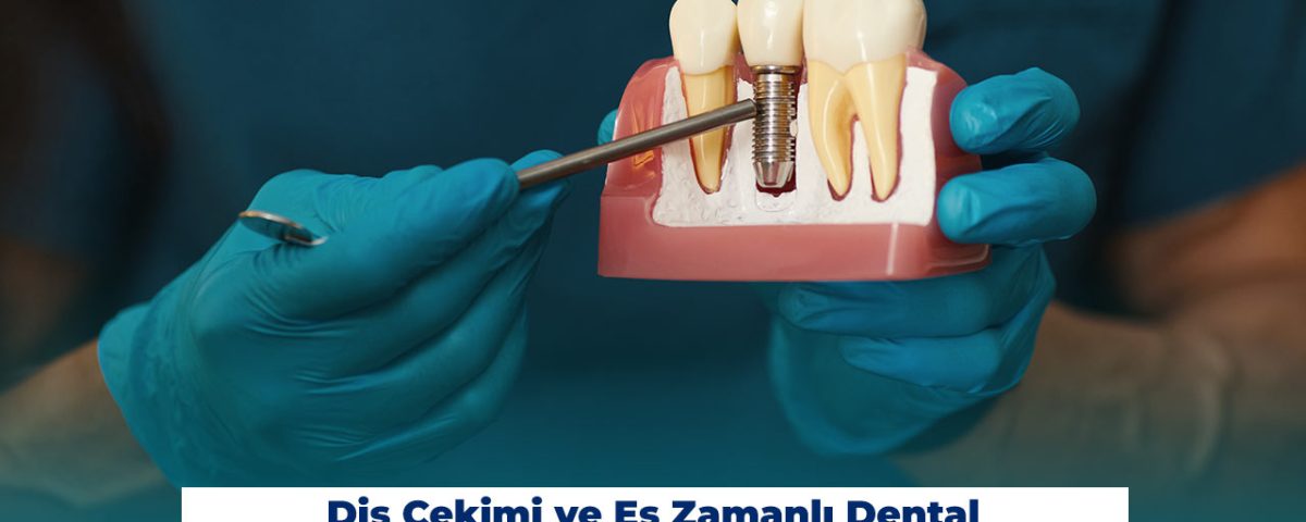 Diş Çekimi ve Eş Zamanlı Dental İmplant Uygulamaları