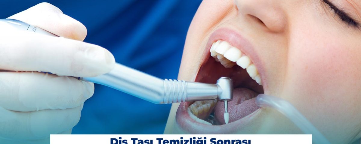 Ağız Bakımı Sonrası Nelere Dikkat Edilmelidir?