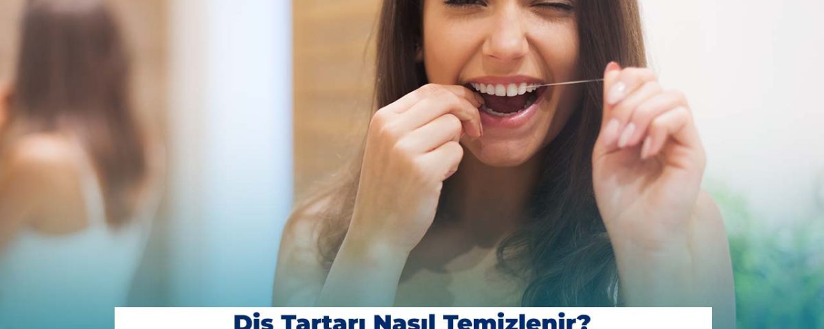 Diş tartarı temizleme işlemi düzenli yapılması gereken bir işlemdir.