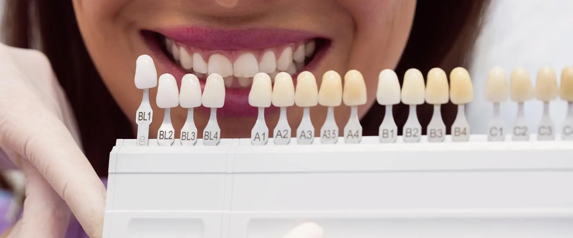 Póngase en contacto con Aliadent para el servicio de recubrimiento dental de circonio en Estambul.