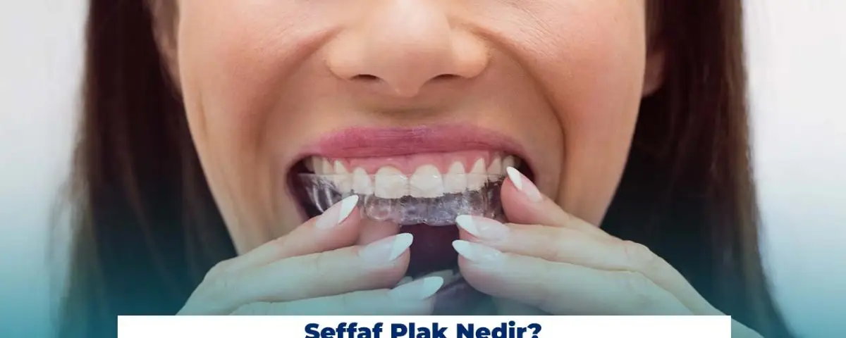 L’utilisation de plaques transparentes est assez courante aujourd’hui.