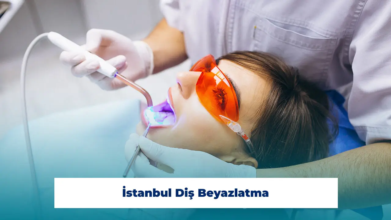 Obtenez des informations détaillées sur le blanchiment des dents à Istanbul.