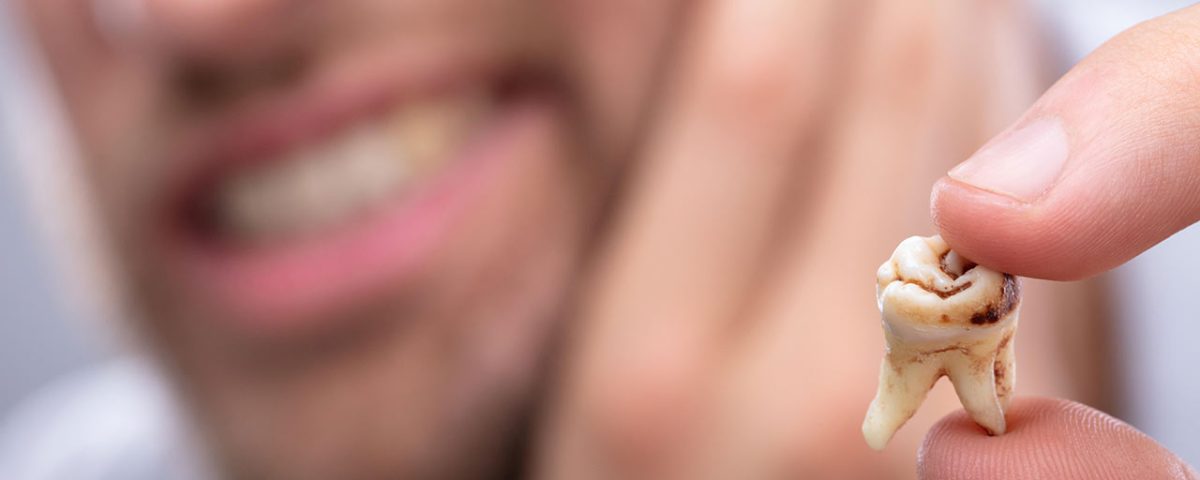 Diş çürüklerini önlemek için ne yapmalıyız biliyor musunuz?