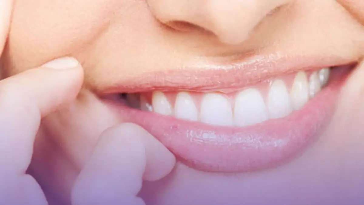 La réduction de la longueur des dents équilibre la longueur des dents à des fins esthétiques et fonctionnelles.