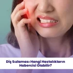Dişlerdeki sızlamalar neyin habercisidir öğrenin.