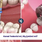 Sizler için doğru olan kanal tedavisi mi diş çekimi mi? Öğrenmeye hazır olun.