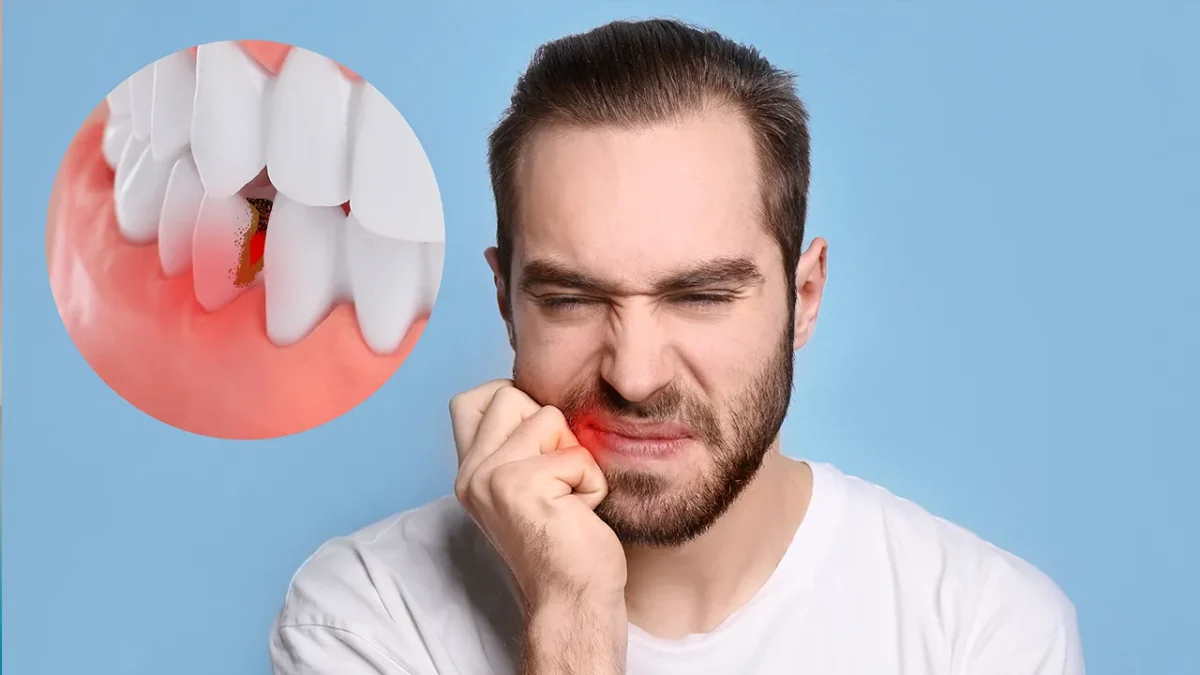 dis sallanmasi tedavisi