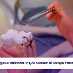 Dolgu tedavisi sonrası ve öncesi işlemleri anlatan, klinik uygulama görseli.