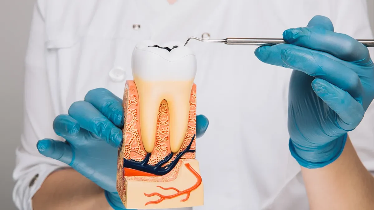 Diş Dolgusu Hakkında En Çok Sorulan 10 Soruyu Yanıtlıyoruz 6 dolgudan sonra cay icilir mi