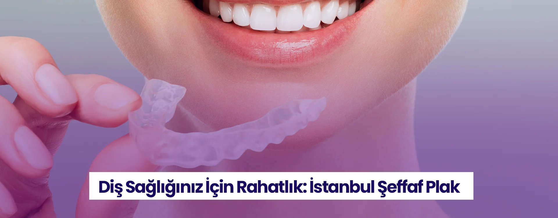 Визуално представяне на услугите за прозрачни табели в Истанбул.