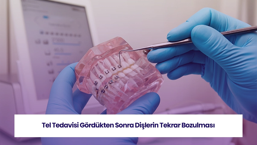 dis teli ciktiktan sonra disler neden ayrilir