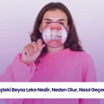 Dişteki beyaz leke, diş minesindeki bozulmaların işareti olabilir ve tedavi gerektirir.