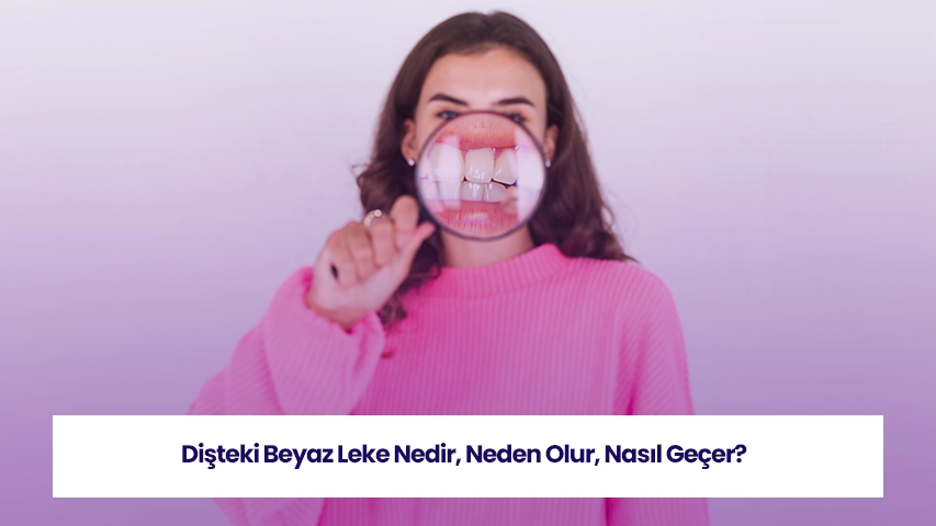 Dişteki beyaz leke, diş minesindeki bozulmaların işareti olabilir ve tedavi gerektirir.