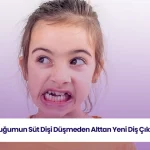 Süt dişi düşmeden kalıcı diş çıkması, çocuk diş gelişiminde görülen bir durumu açıklar.