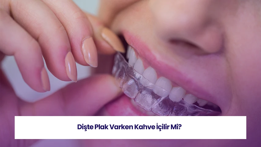 Dişte plak varken kahve içilir mi sorusu, diş sağlığı açısından önemlidir.