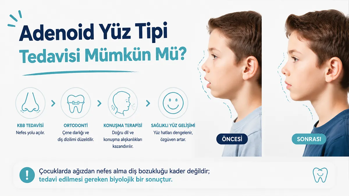 Geniz Eti Yüzü: Çocuğunuz Sürekli Ağzı Açık Mı Uyuyor? 5 agzi acik uyuyan cocugun cene yapisi